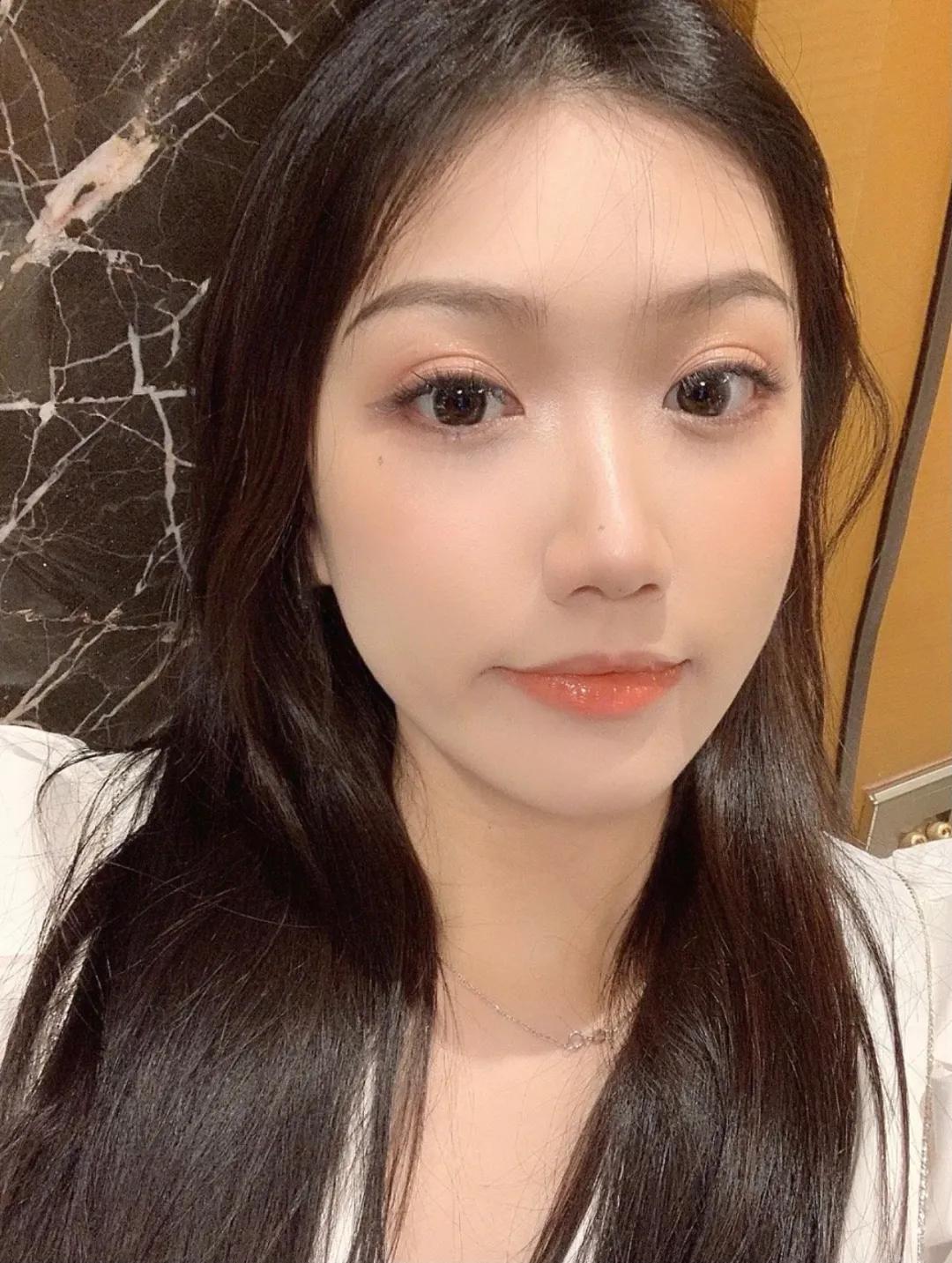 点痣就能变美,点痣整容大法