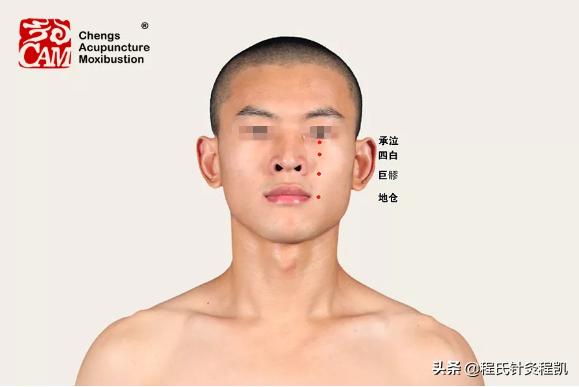 面瘫面神经炎中医调理方法,小儿面神经炎中医如何治疗