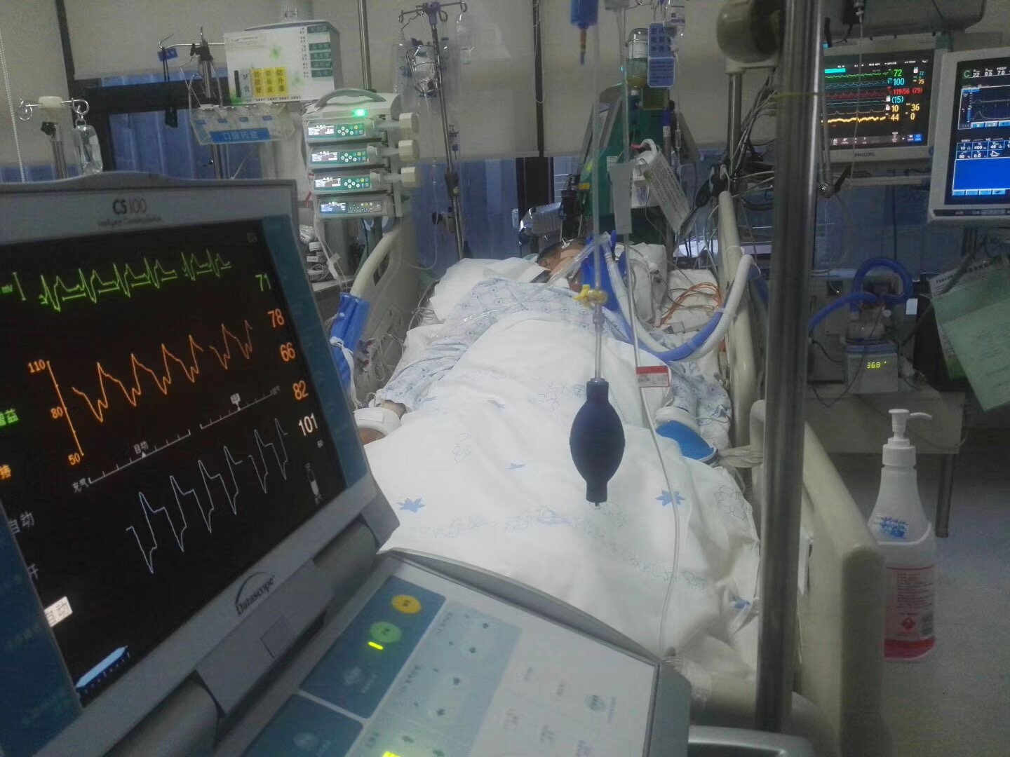 用了头孢有什么副作用,用了头孢喝酒会怎样