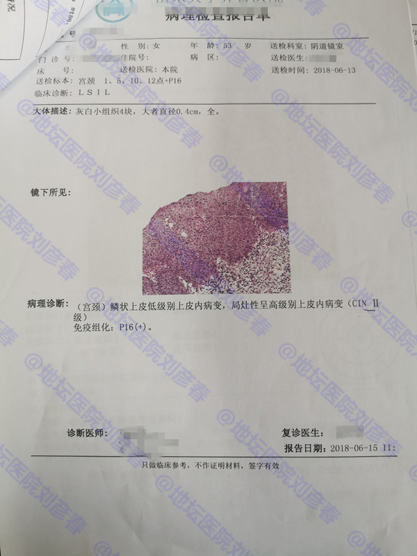 宫颈病变一级用干扰素能治好吗,慢性宫颈炎干扰素用法用量及疗程