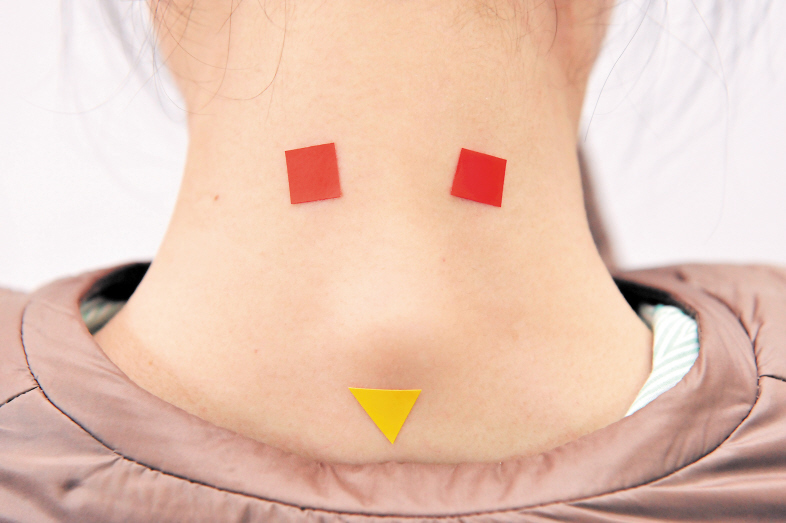 路医生说丨脖子后面的“富贵包”，是肿瘤么？真的会瘫痪夺命么？