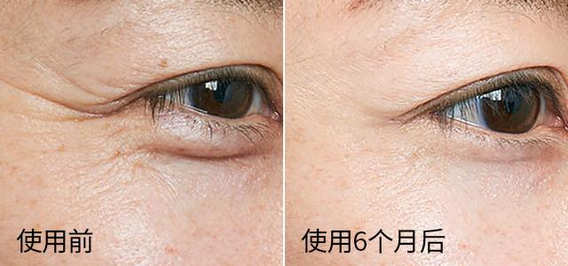 越敷越白胶原蛋白面膜,越敷皮肤越嫩的泥膜