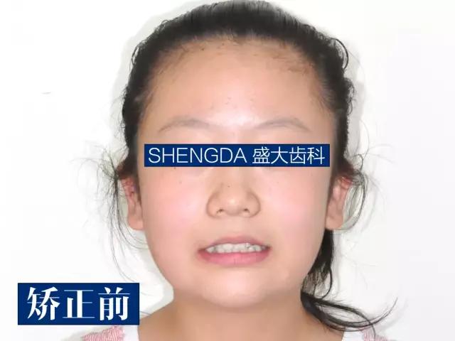 山西“爱马仕”级别齿科医院！get明星同款笑容