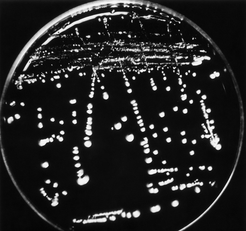 女性感染念珠菌有什么症状吗,念珠菌吃什么水果最好