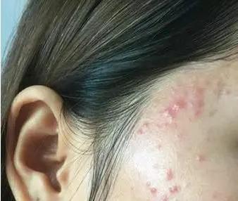 媲美“刘诗诗的百万修图师”，有了这款面膜，你也能拥有好皮肤