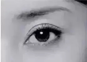 怎么知道自己最适合哪种双眼皮,双眼皮有哪几种类型图片