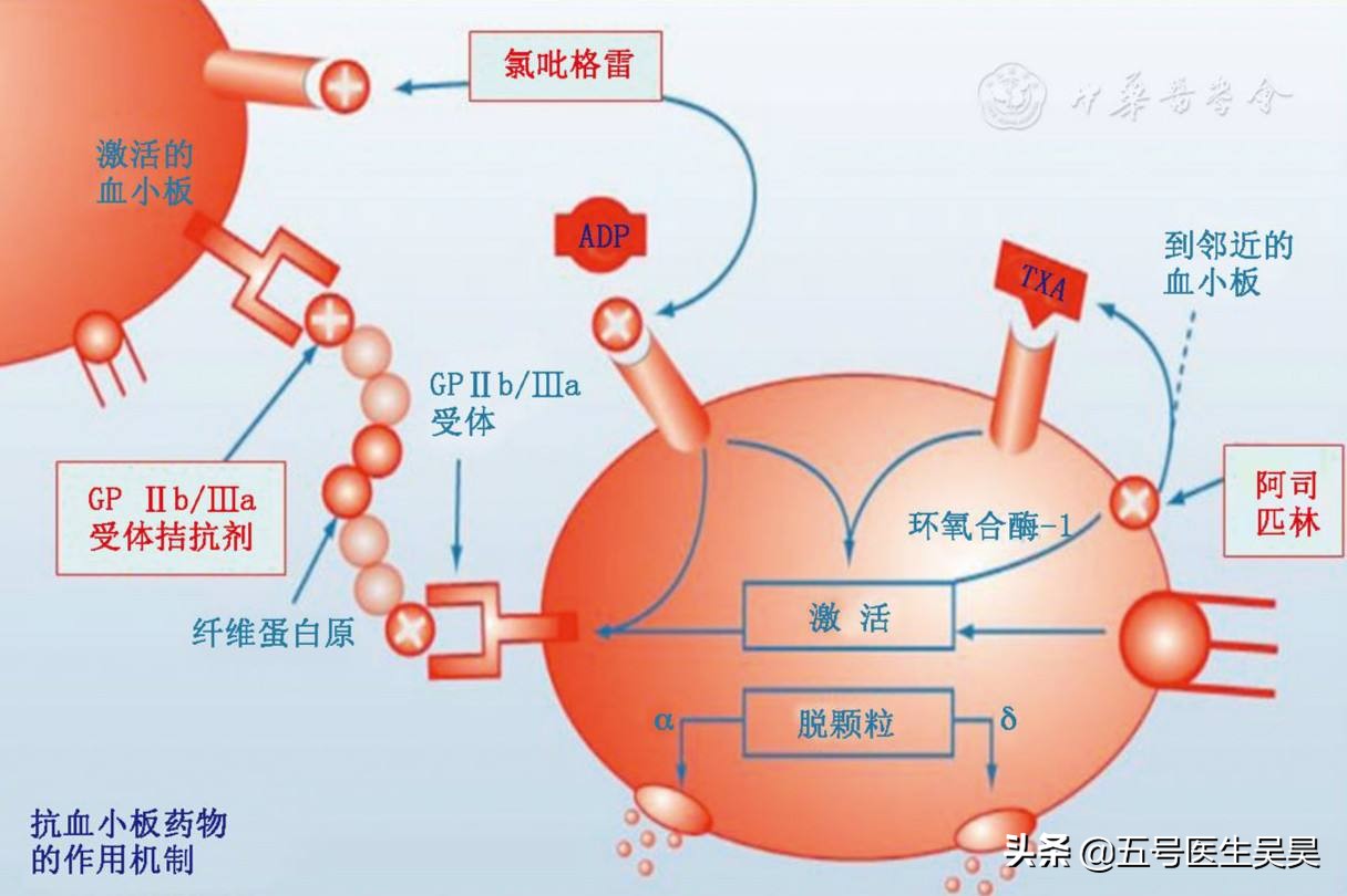 切息肉需要停阿司匹林吗,服用阿司匹林不能手术吗