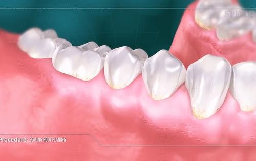 简单三招告别口臭尴尬,口臭的小妙招一招搞定