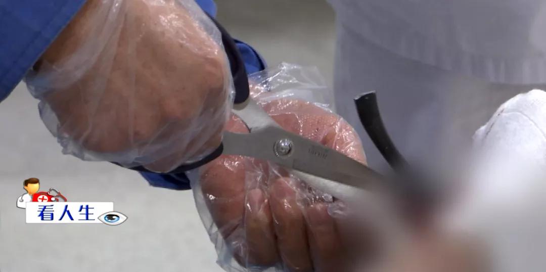 被电动车追尾电动车的人受伤了,被电动车撞的老太太