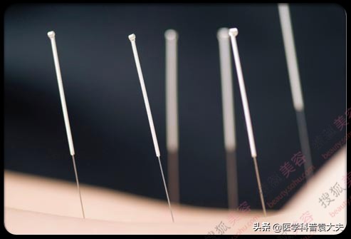 腰椎骨质增生治疗最佳方法,腰椎骨质增生的最佳治疗方法