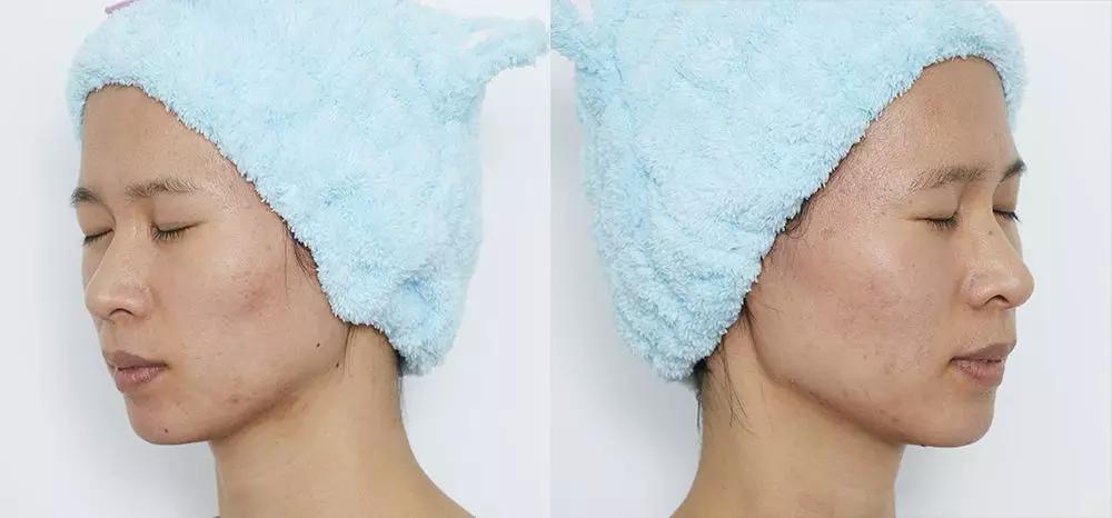 真人改造|不靠医美，一天实现“换皮”