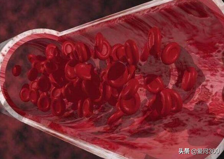 70岁老人血粘度低,老人血粘度偏高怎么调理