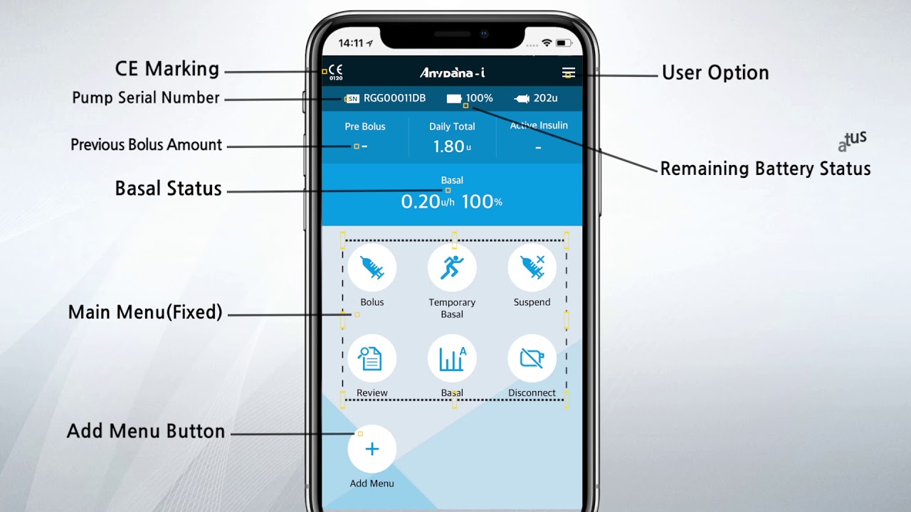 最新全自动的闭环胰岛素泵,丹纳rs胰岛素泵