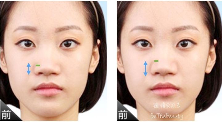 鼻梁很塌怎么画修容,塌鼻子大鼻头怎么画鼻影