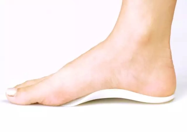 扁平足的危害一岁宝宝,现在的小孩好多的是扁平足