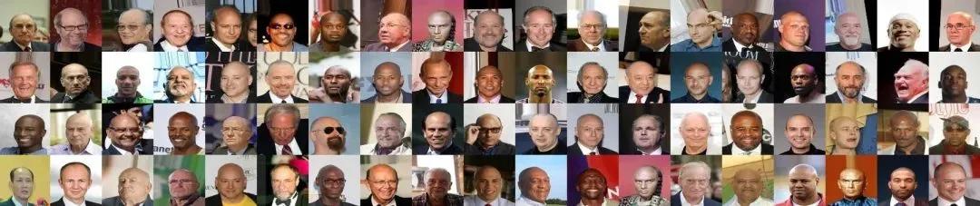 所以秃头的标准是发际线高≥7cm？头秃代表不再是中老年独扛大旗，90后、00后也在积极踊跃加入组织