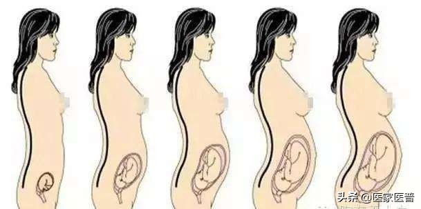 产后科普视频,产后科普之产后腰痛