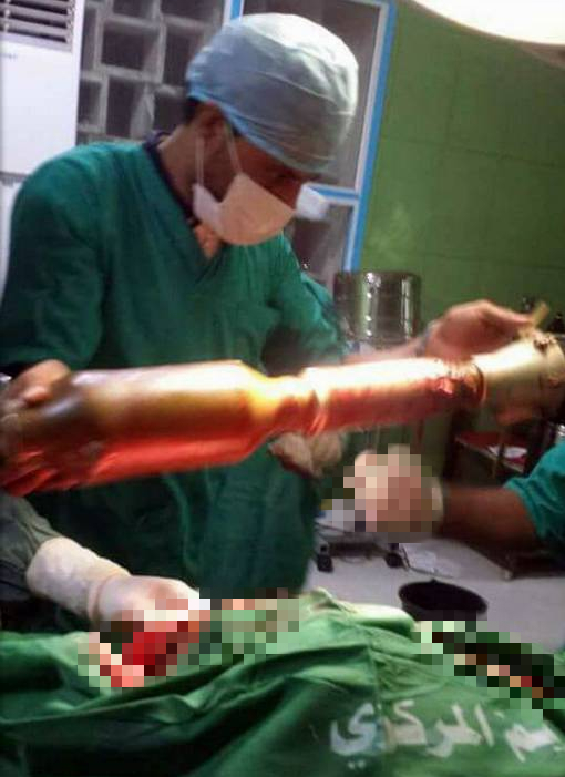 迫击炮真实战争,迫击炮rpg