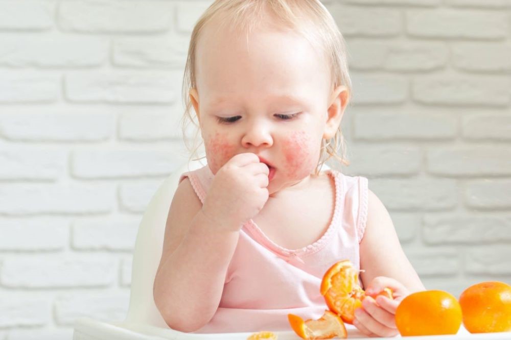 宝宝反复湿疹对付湿疹有妙招,战胜湿疹成功上岸