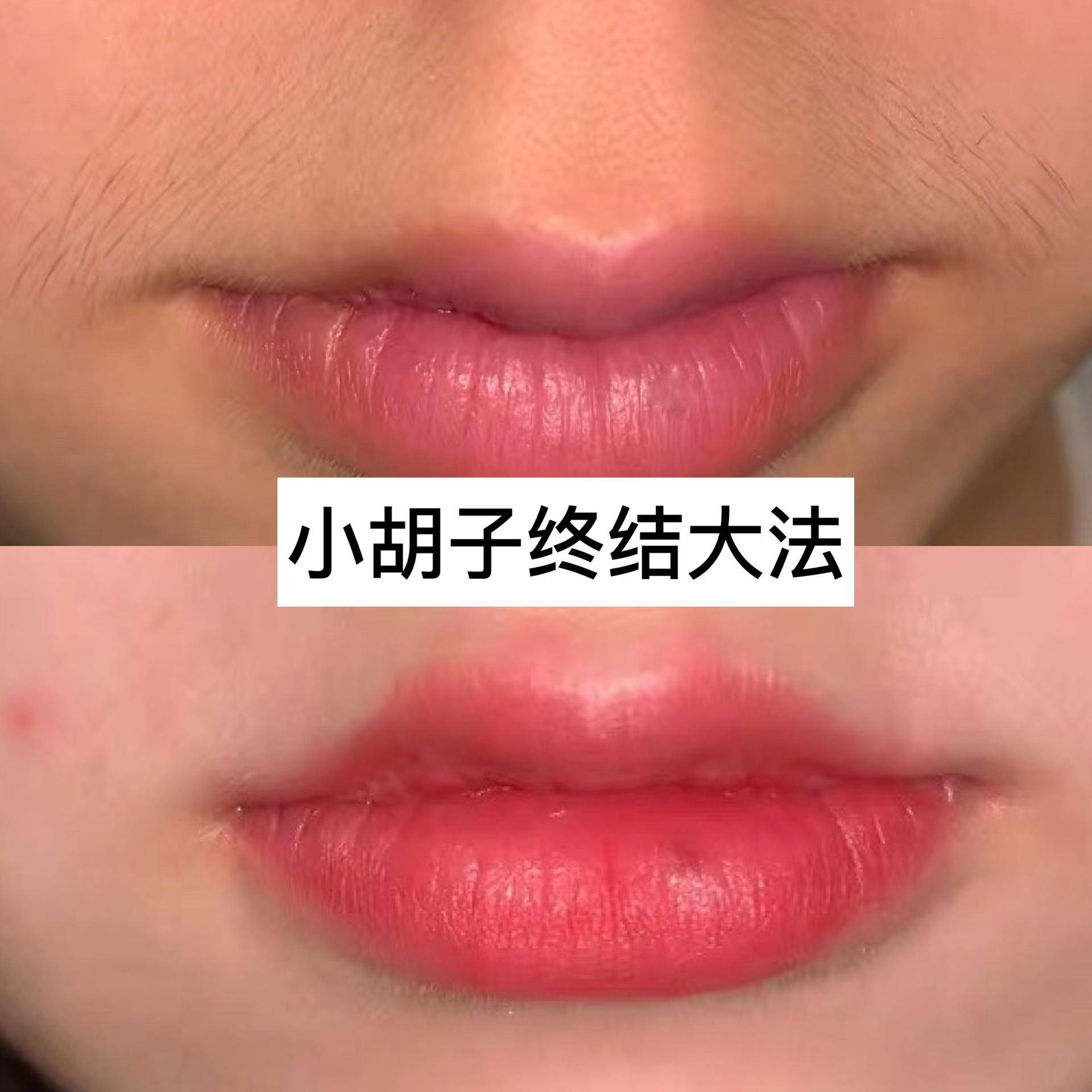 脱毛用什么可以不长,脱毛全攻略不再毛手毛脚