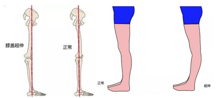 荒野健康：手把手1V1教你瘦腿，不再盲目训练啦
