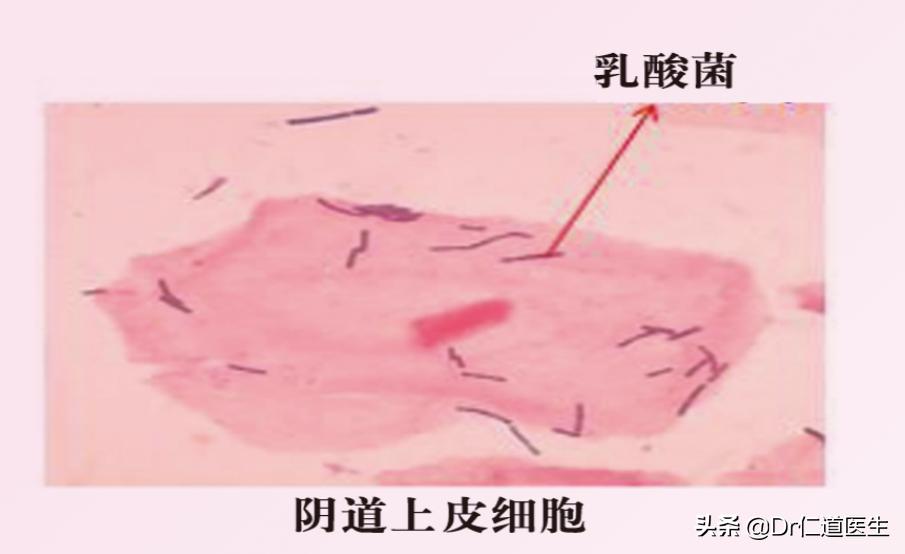 女性得霉菌是什么原因导致的,如果女性染上霉菌怎么办