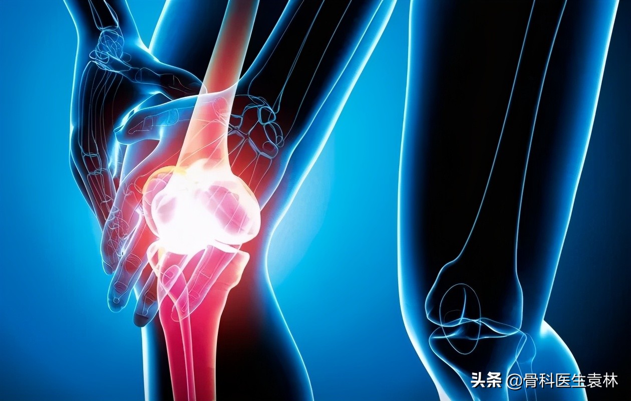 骨质增生最严重的后果是什么,骨质增生是怎么造成的原因是什么