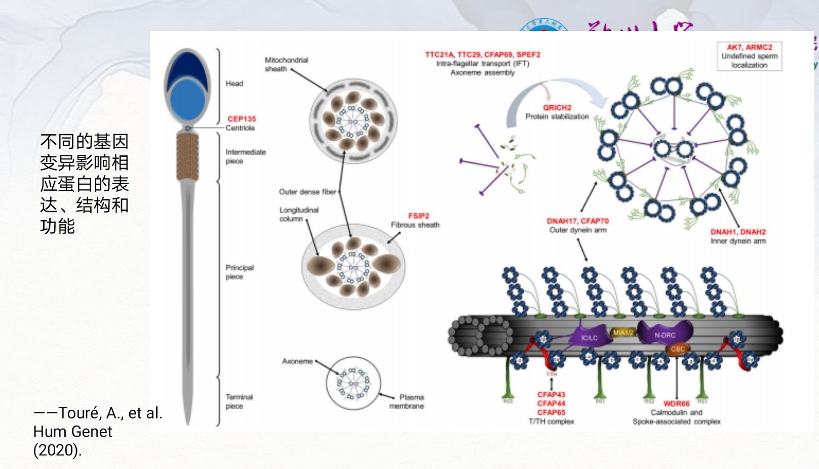 严重弱精症和完全无活动精子的原因是啥？