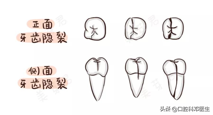 新型冠状病毒肺炎患者怎么治疗,新肺炎疫情有无治疗方法