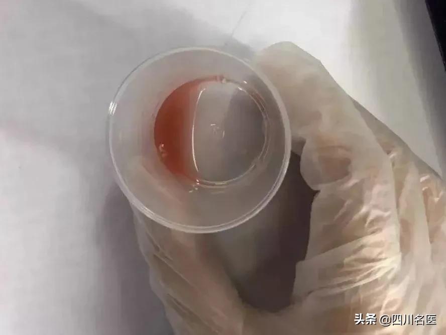 精子是如何产生的百科,精子是不是每天都能生成