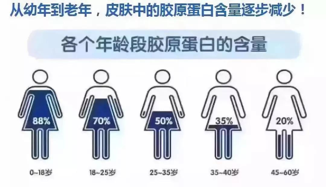 改善皱纹松弛抗皱乳液,抗皱松弛淡化皱纹鱼尾纹