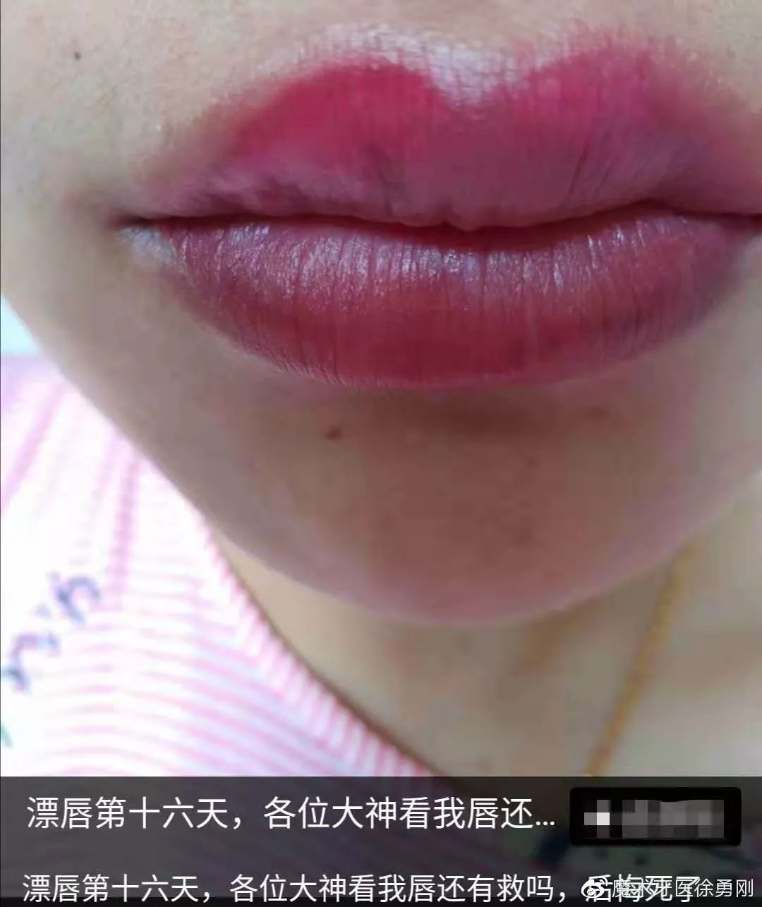 内行人为什么不建议漂唇,作为一名医生一直被人质疑