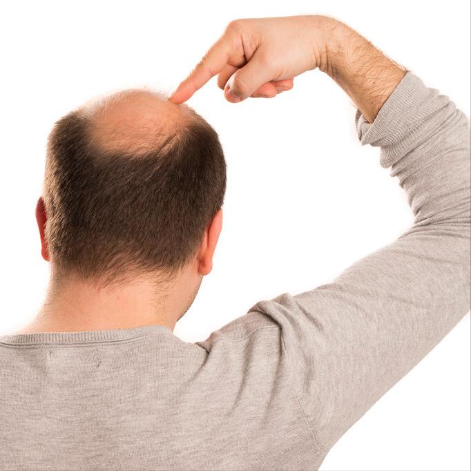 植发后怎么才能长得更好,植发之后和本来的头发有区别吗