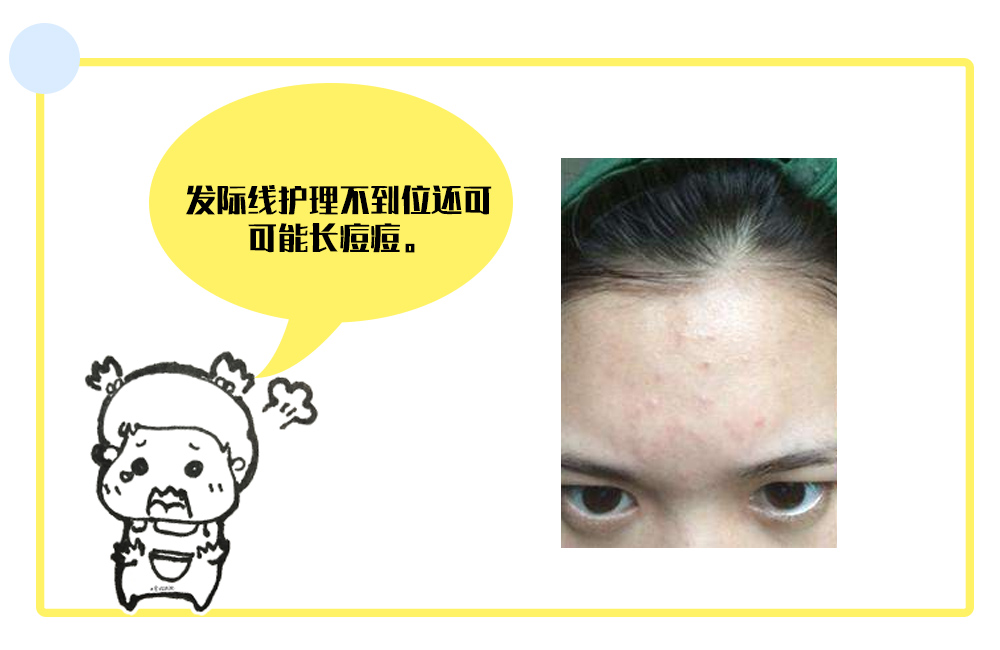 发际线高女生怎么变美,短脸发际线高变美思路