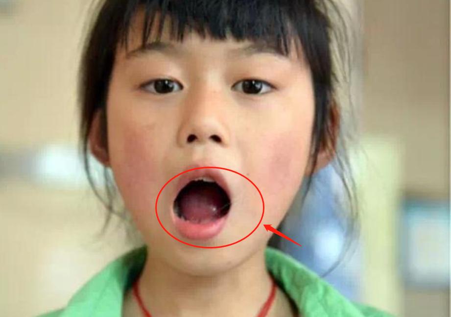 9岁女孩天生超能力，张开嘴就能喷水，网友直呼像《葫芦娃》水娃