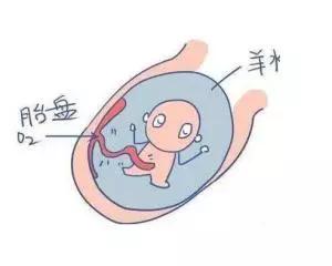 羊水过少怎么补救,羊水过少喝了很多水还是少怎么办