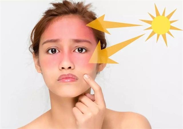 军训防晒护肤全套流程,军训晒黑急救护肤