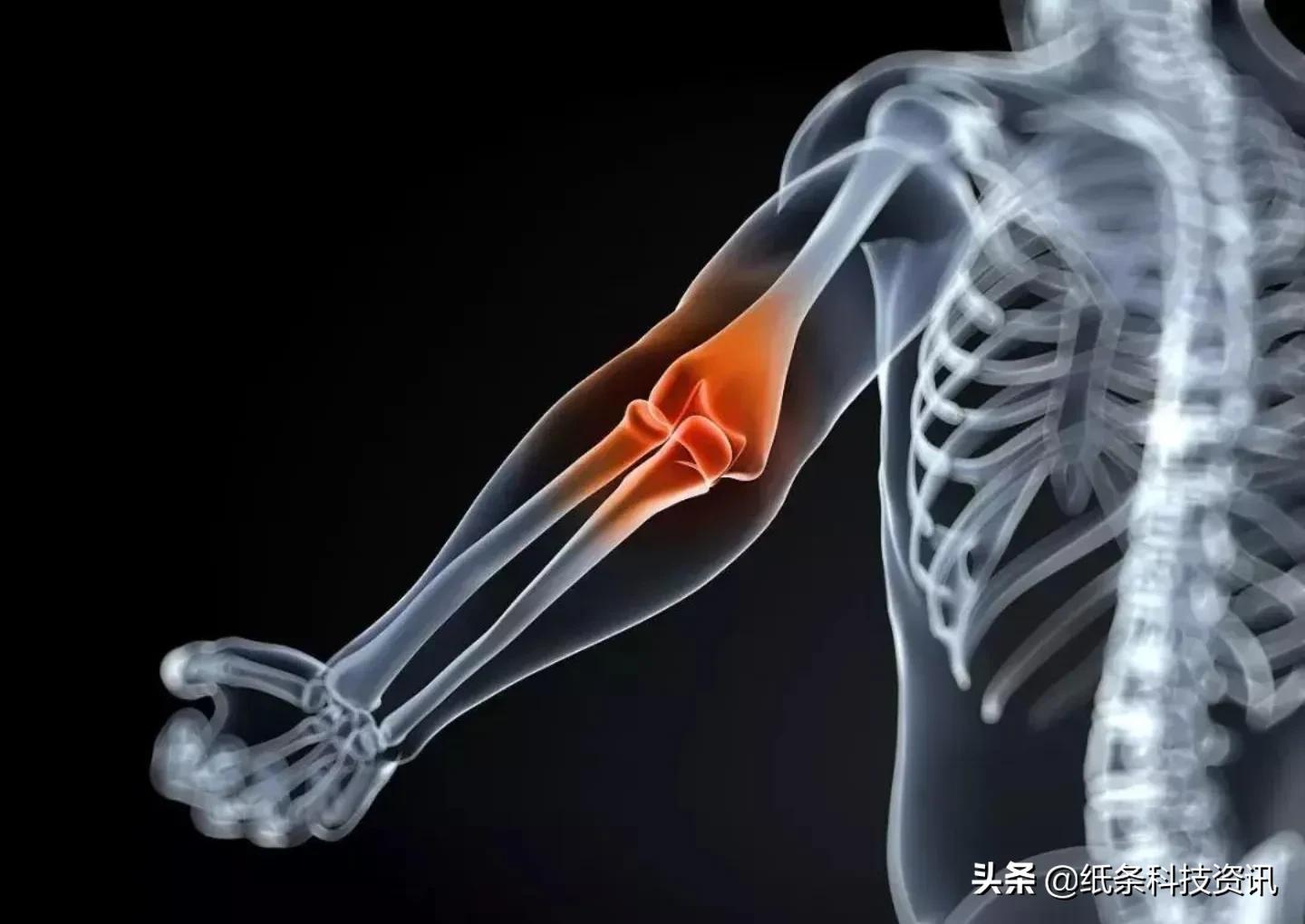 德国越狱真的不犯法吗,德国有越狱成功的案例吗