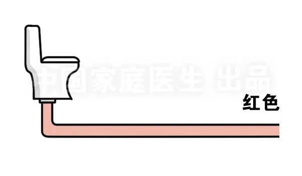 肝肾出现问题所表现的综合征,上厕所有四个症状说明肝有问题