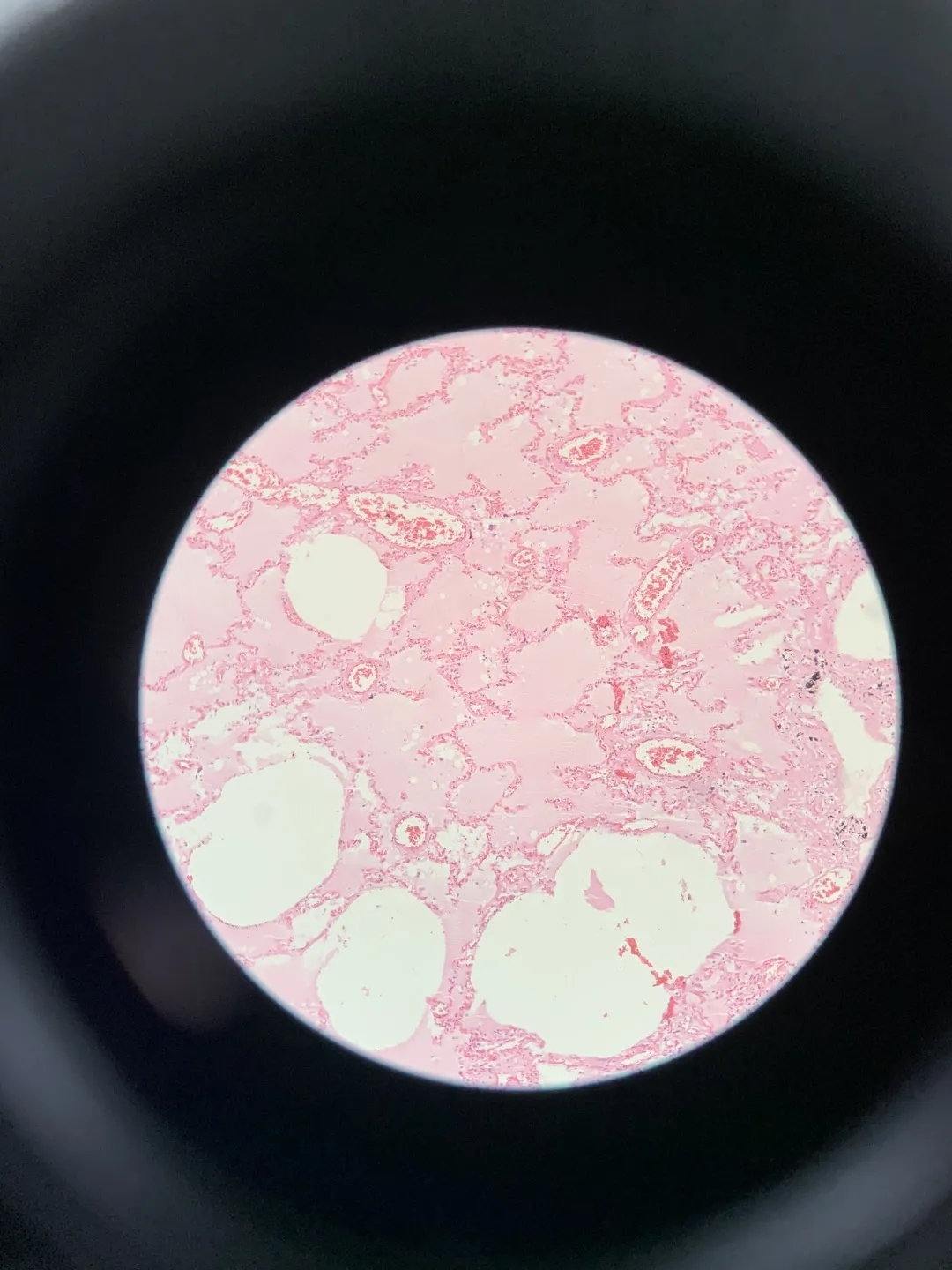 医学生学习打卡做题,医学生学习成果检验视频