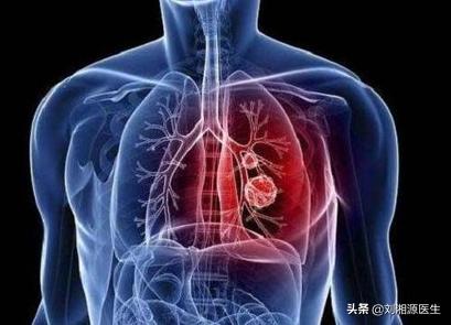 系统性血管炎怀孕能要吗,怀孕得了血管炎怎么办