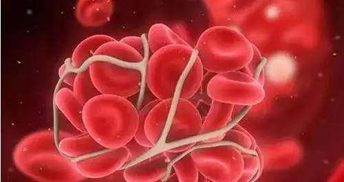 深海鱼油抗癌么,深海鱼油预防心脑血管