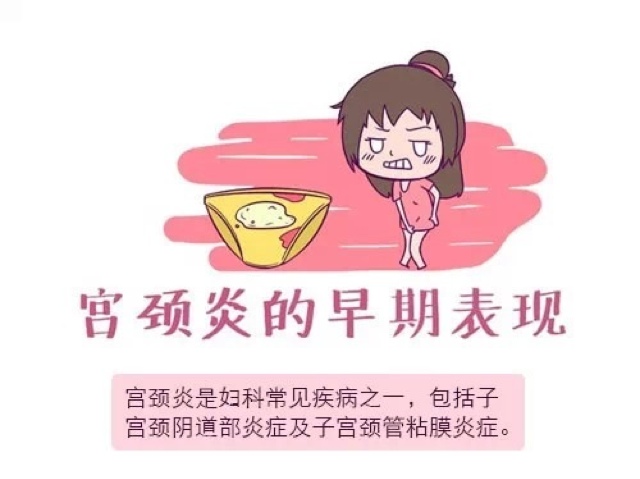 妇科炎症的症状怎么锻炼,治疗妇科炎症的小秘诀