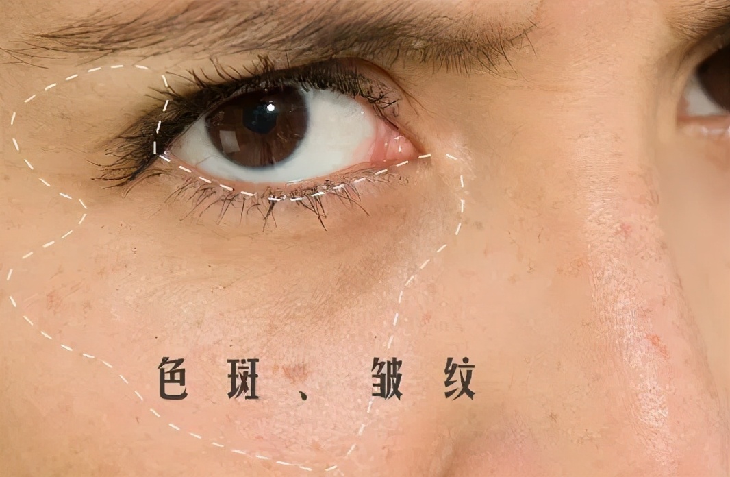 资生堂蓝胖子防水防汗测评,蓝胖子防晒霜资生堂清爽型