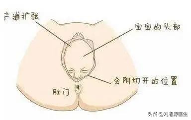 免疫性不良妊娠保胎成功,免疫治疗不良妊娠的方法