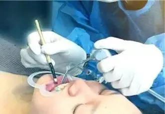 牙齿美容未来的趋势,牙齿美容这个项目前景如何