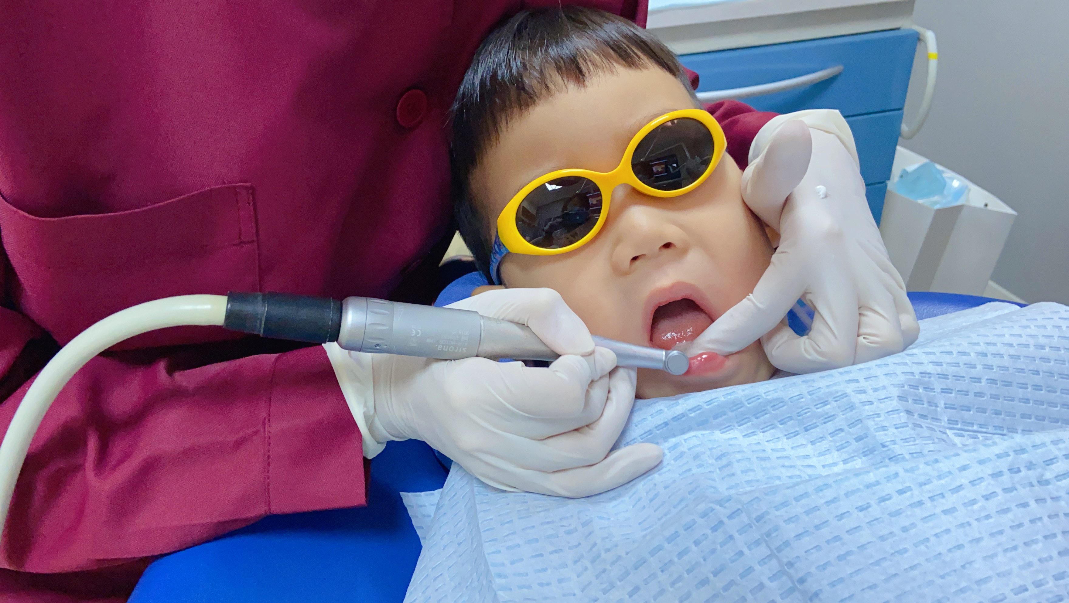 儿童牙涂氟了还需要用含氟牙膏,小孩刷牙牙膏含氟好还是不含氟好