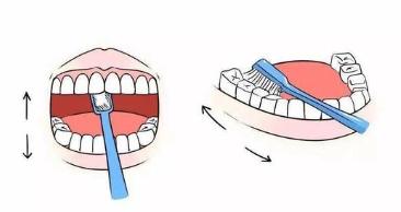 拔牙后出血自我处理小妙招,拔牙后明显出血该怎么办