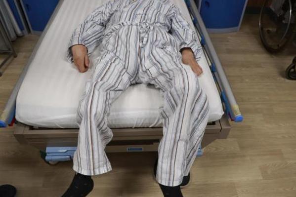 30岁强直性脊柱炎中医治愈案例,王永福院士治疗强直性脊柱炎案例