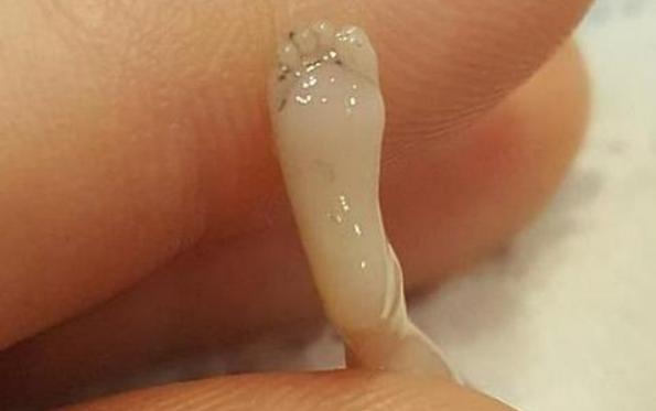 人工流产胎儿医院怎么处理,人工流产胎儿最后如何处置